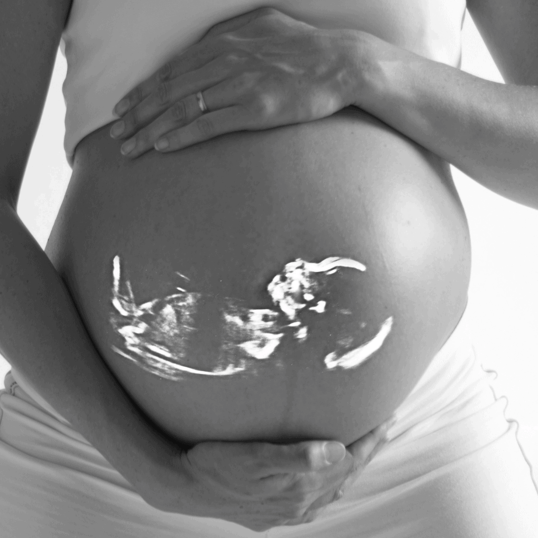 Healthy Pregnancy Ultrasound